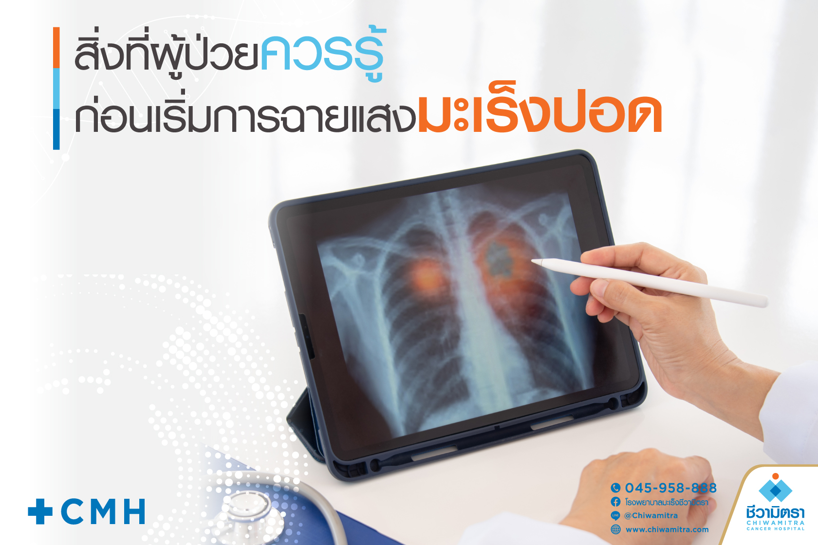 สิ่งที่ผู้ป่วยควรรู้ก่อนเริ่มการฉายแสงมะเร็งปอด