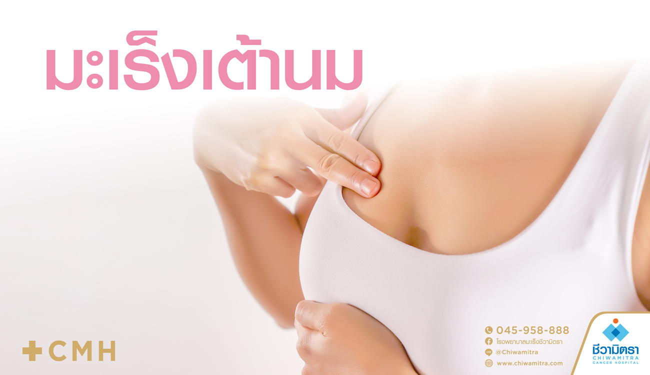 มะเร็งเต้านม (Breast Cancer)