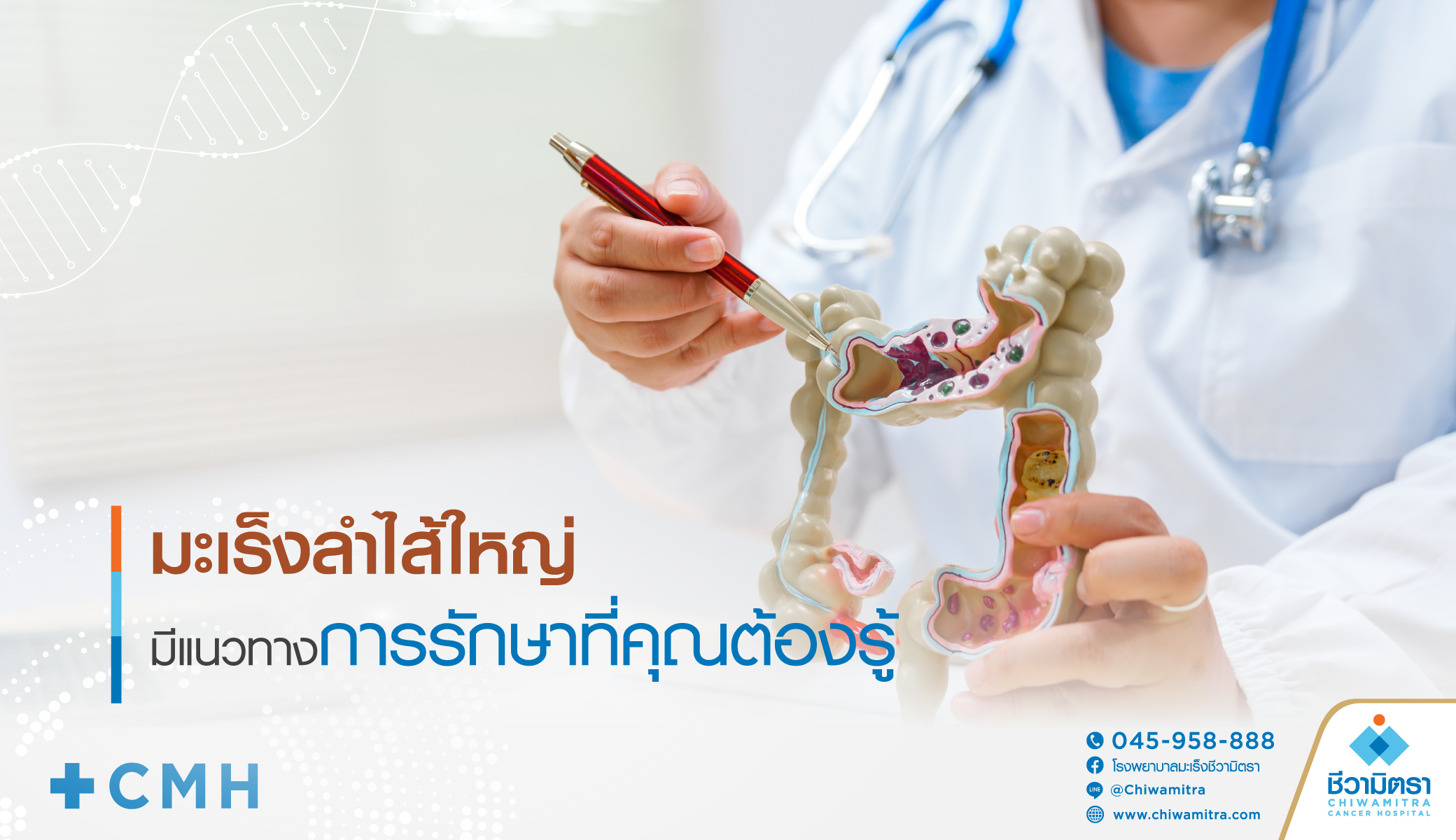 มะเร็งลำไส้ใหญ่สามารถรักษาได้ เรียนรู้แนวทางการรักษาและการดูแลตัวเอง