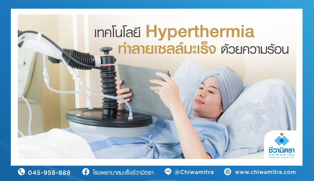 เทคโนโลยี Hyperthermia ทำลายเซลล์มะเร็งด้วยความร้อน