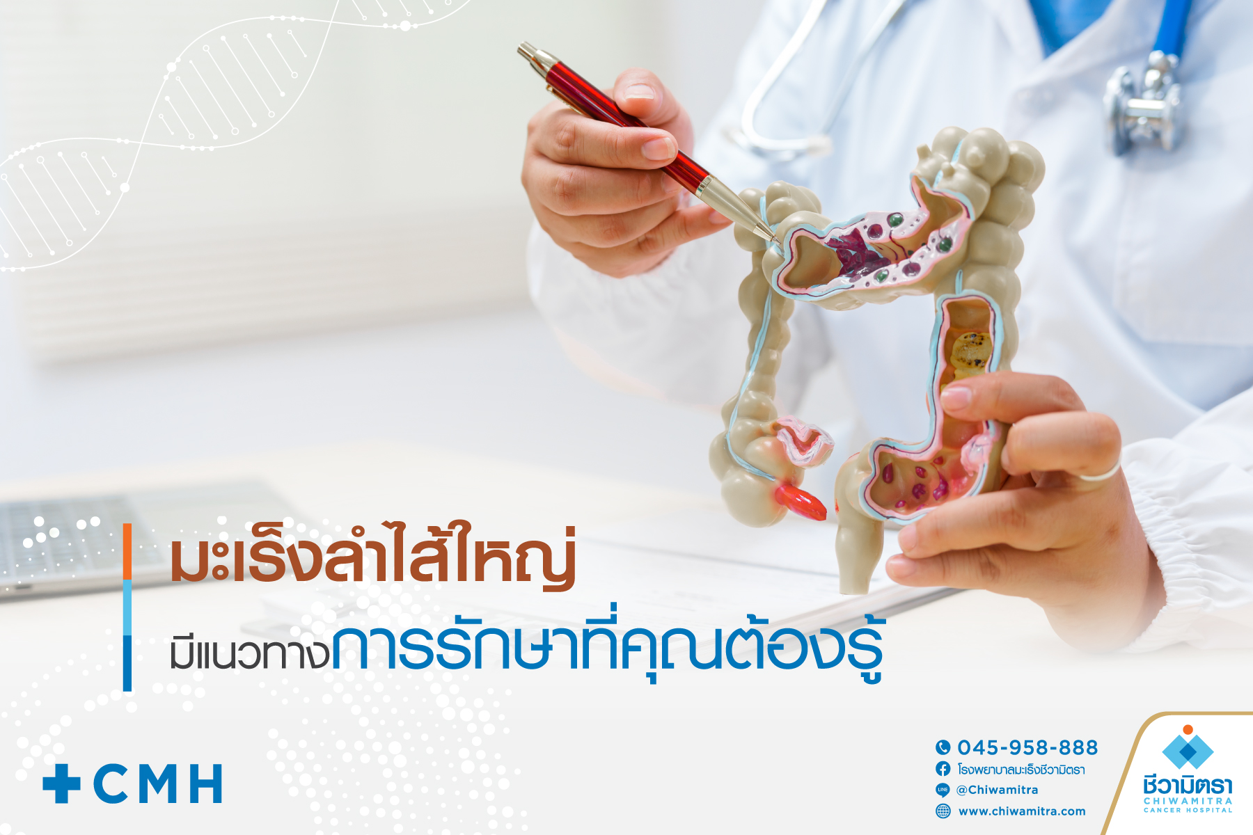 มะเร็งลำไส้ใหญ่สามารถรักษาได้ เรียนรู้แนวทางการรักษาและการดูแลตัวเอง