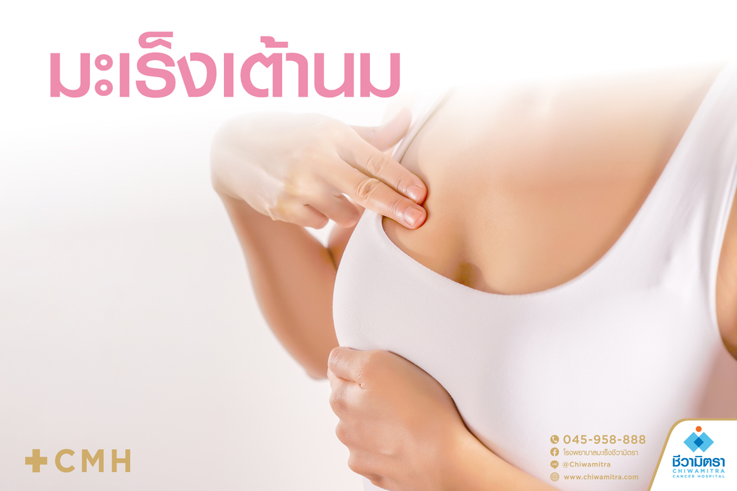 มะเร็งเต้านม (Breast Cancer)