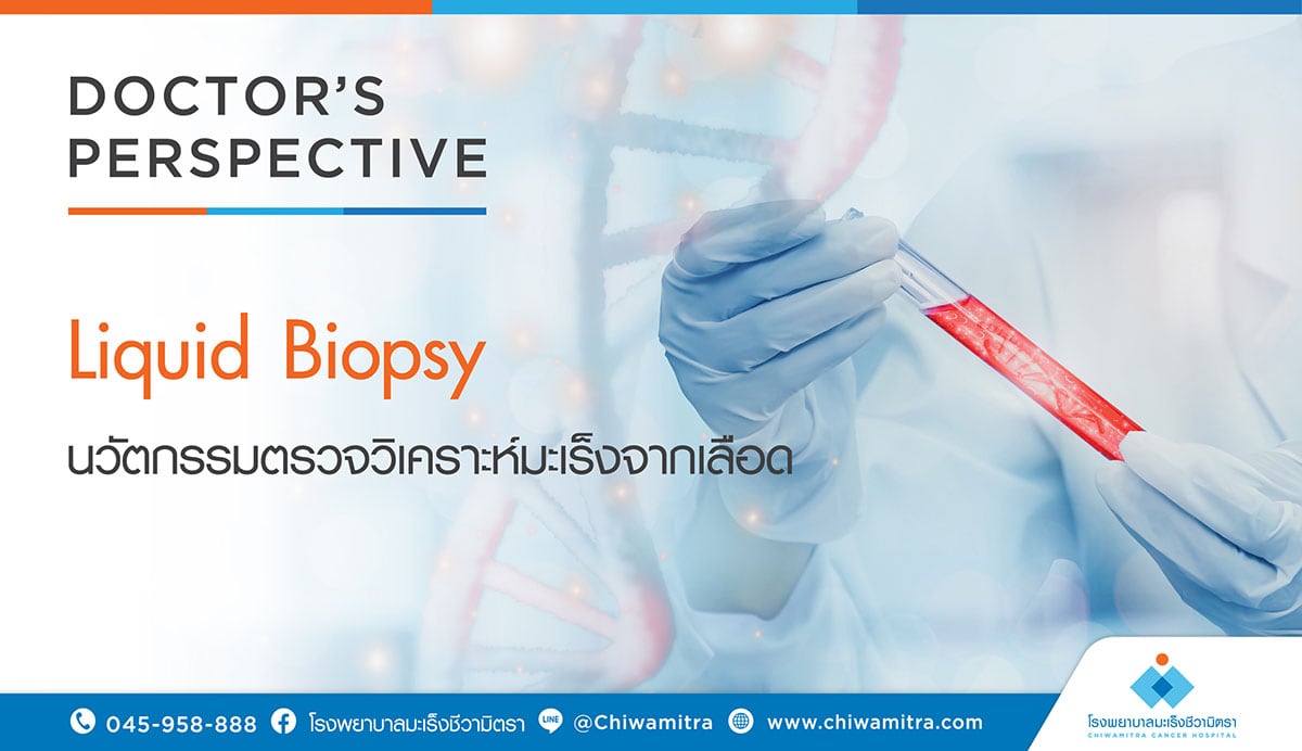 Liquid Biopsy นวัตกรรมตรวจวิเคราะห์มะเร็งจากเลือด